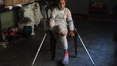 تقرير أممي: 4500 شخص في غزة بحاجة إلى أطراف اصطناعية وسط تحديات إدخالها للقطاع