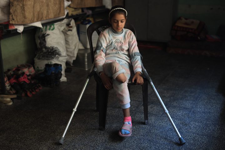 تقرير أممي: 4500 شخص في غزة بحاجة إلى أطراف اصطناعية وسط تحديات إدخالها للقطاع