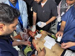 إصابة عدد من الكوادر الطبية بعد قصف طيران الاحتلال البوابة الخلفية لمستشفى الكويت التخصصي بمواصي خانيونس.