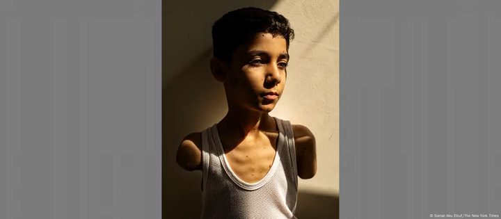 صورة طفل من غزة فقد ذراعيه خلال الحرب تفوز بجائزة "صورة العام"