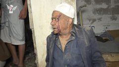 شهداء وإصابات في قصف أمريكي وحشي استهدف سوق فروة الشعبي بالعاصمة اليمنية صنعاء واليمينون يصرحون : "دماؤنا وأموالنا فداء لأهل غزة ".