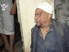 شهداء وإصابات في قصف أمريكي وحشي استهدف سوق فروة الشعبي بالعاصمة اليمنية صنعاء واليمينون يصرحون : "دماؤنا وأموالنا فداء لأهل غزة ".