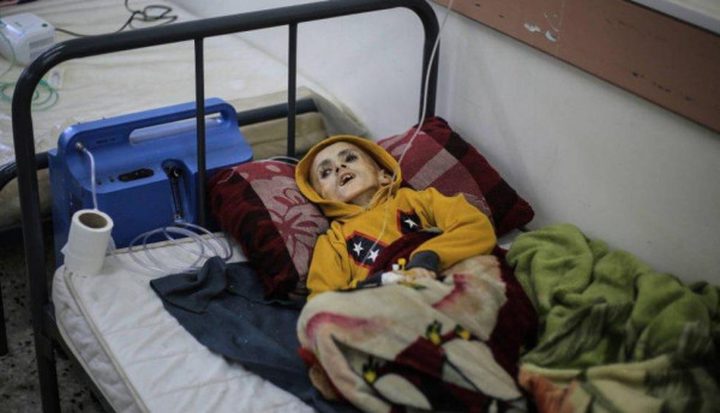 مدير مستشفى شهداء الأقصى: قطاع غزة دخل المرحلة الخامسة من سوء التغذية وهي الأخطر