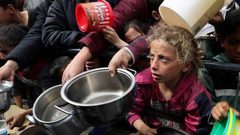 استشهاد 326 فلسطينيًا بسبب سوء التغذية و300 حالة إجهاض خلال 80 يومًا