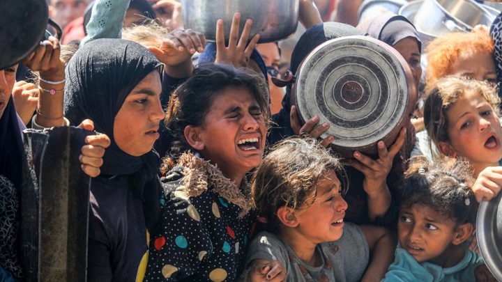 ٧٠ الف طفل يواجهون سوء التغذية في غزة