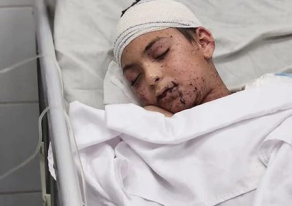 17 طفلًا من غزة يتلقون العلاج في إيطاليا بينهم آدم النجار شقيق 9 شهداء