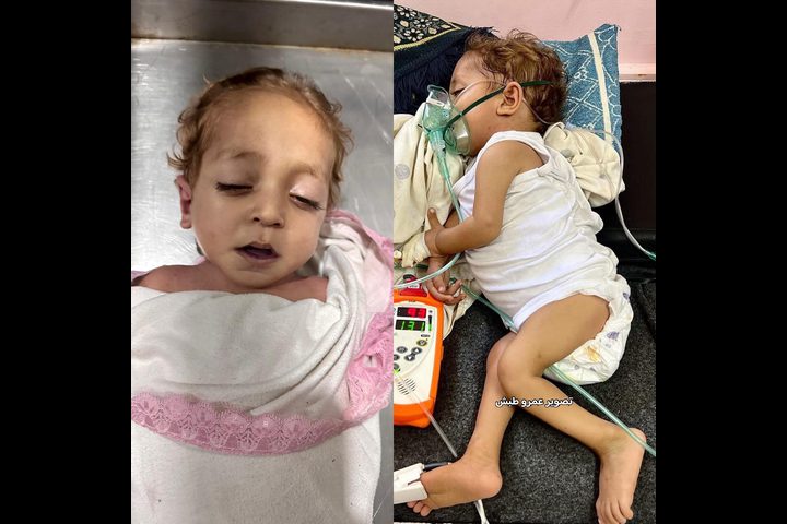 وفاة طفل من قطاع غزة نتيجة حرمانه من العلاج