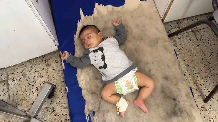 35 حالة حمى شوكية بين الأطفال في مجمع ناصر بخانيونس