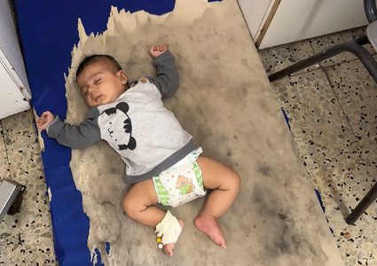 35 حالة حمى شوكية بين الأطفال في مجمع ناصر بخانيونس