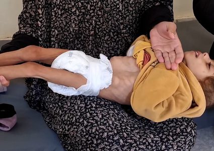 الصحة في غزة: القطاع يشهد مجاعة فعلية وارتفاعاً في الوفيات نتيجة سوء التغذية