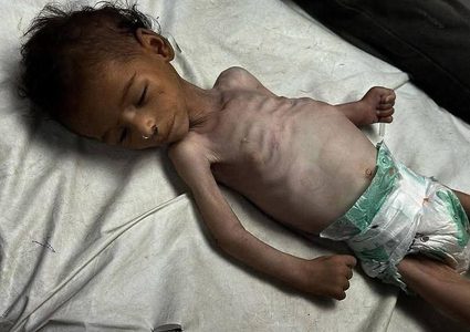 استشهد جوعاً.. الرضيع فادي  "3 أشهر" من خانيونس، والذي استشهد نتيجة الجوع والحصار