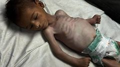 استشهد جوعاً.. الرضيع فادي  "3 أشهر" من خانيونس، والذي استشهد نتيجة الجوع والحصار