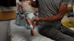 استشهد جوعاً.. الرضيع فادي  "3 أشهر" من خانيونس، والذي استشهد نتيجة الجوع والحصار