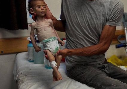 استشهد جوعاً.. الرضيع فادي  "3 أشهر" من خانيونس، والذي استشهد نتيجة الجوع والحصار