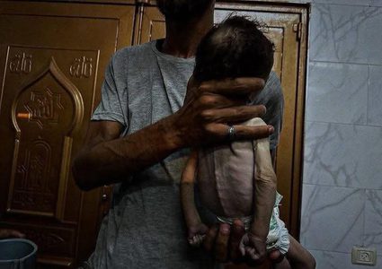 استشهد جوعاً.. الرضيع فادي  "3 أشهر" من خانيونس، والذي استشهد نتيجة الجوع والحصار