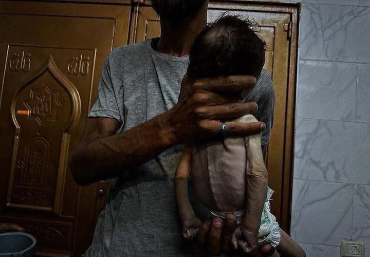 استشهد جوعاً.. الرضيع فادي  "3 أشهر" من خانيونس، والذي استشهد نتيجة الجوع والحصار