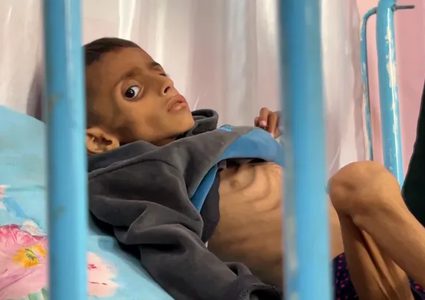 صحة غزة تطلق نداءً عاجلاً: أكثر من مليوني إنسان يواجهون الجوع في كارثة الإنسانية