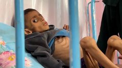 صحة غزة تطلق نداءً عاجلاً: أكثر من مليوني إنسان يواجهون الجوع في كارثة الإنسانية