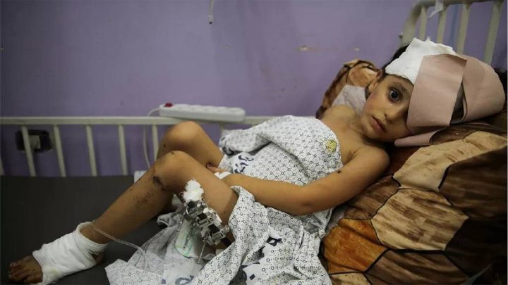 مستشفى العيون: تسجيل 1200 حالة جديدة فقدت البصر كليا أو جزئيا في حي النصر وغزة
