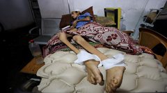 "الشلل الرخو الحاد" يصيب العشرات في غزة.. ما هو؟