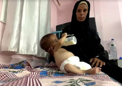 "بنتي ما بتكبر"  أم من غزة تروي معاناة طفلتها المصابة بسوء التغذية