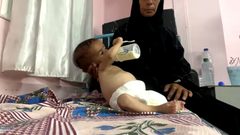 "بنتي ما بتكبر"  أم من غزة تروي معاناة طفلتها المصابة بسوء التغذية