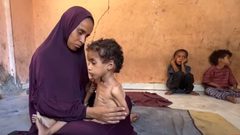 حين يصحو الطفل مشلولًا... غزة تحتضر وعضلات أطفالها تذبل