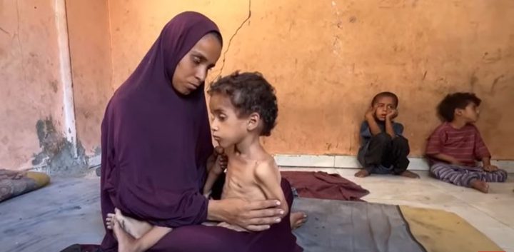 حين يصحو الطفل مشلولًا... غزة تحتضر وعضلات أطفالها تذبل