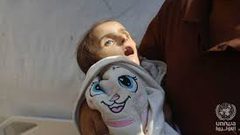 المجاعة تتفاقم .. استشهاد طفل جديد نتيجة الجوع وسوء التغذية