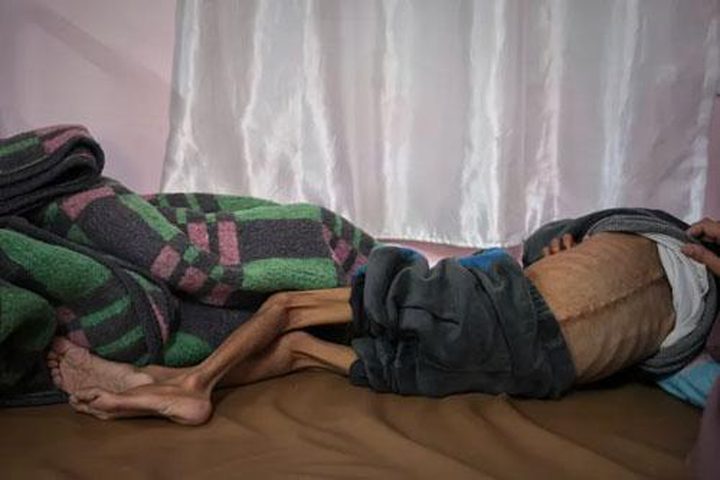وفاة 7 مواطنين بسبب المجاعة وسوء التغذية في قطاع غزة في غضون 24 ساعة