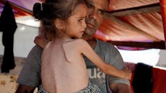 اليونيسيف: واحد من كل 3 أشخاص بغزة يقضي أياما دون طعام