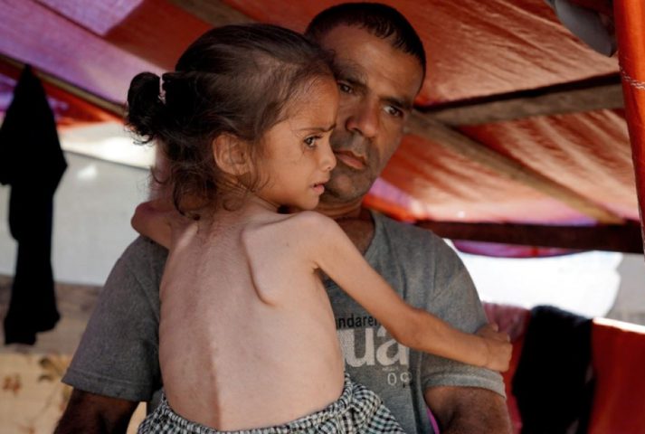 اليونيسيف: واحد من كل 3 أشخاص بغزة يقضي أياما دون طعام
