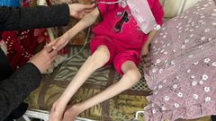 المجاعة في قطاع غزة تدخل مرحلتها الخامسة