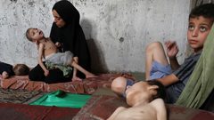 ارتفاع عدد شهداء التجويع الإسرائيلي في غزة إلى 188 بينهم 94 طفلا