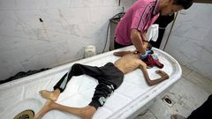 4 شهداء نتيجة المجاعة وسوء التغذية خلال الـ24 ساعة الماضية