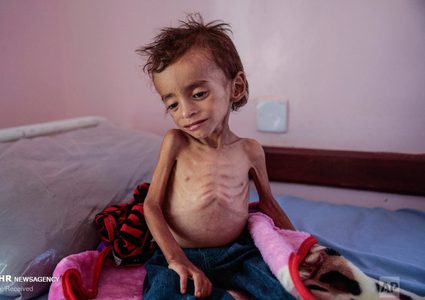 خلال 24 ساعة .. وفاة أربعة مواطنين بسبب سوء التغذية والمجاعة في قطاع غزة