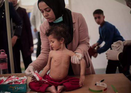 "اليونيسف": 112 طفلًا يدخلون دائرة سوء التغذية يوميًا في قطاع غزة
