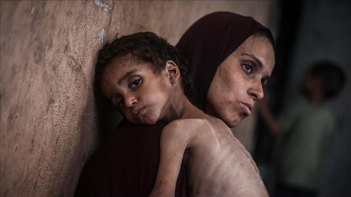 إعلامي غزة: أكثر من 40 ألف رضيع مهددون بالموت بسبب الجوع