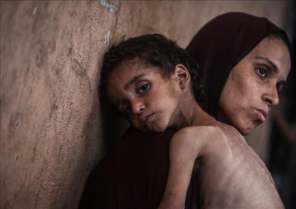 إعلامي غزة: أكثر من 40 ألف رضيع مهددون بالموت بسبب الجوع