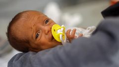 "أونروا": حالات سوء التغذية بين الأطفال في غزة زادت بمقدار 3 مرات