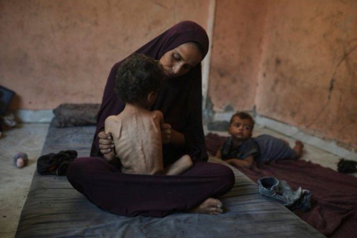 "أوتشا": تفاقم المجاعة وسوء التغذية وأزمة المأوى في قطاع غزة