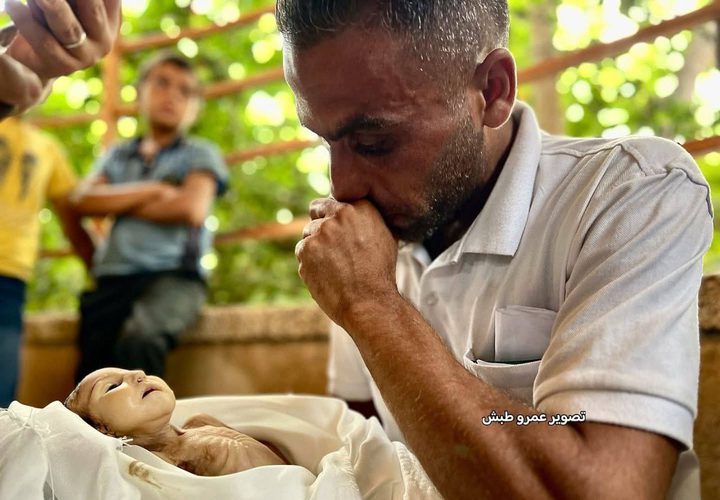وفاة الطفلة غدير بريكة ( 5 أشهر) نتيجة إصابتها بسوء التغذية وعدم التوفر العلاج اللازم لحالتها الصحية بعد ولادتها، بفعل حصار غزة وحرب الإبادة المستمرة