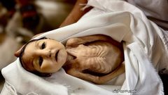 وفاة الطفلة غدير بريكة ( 5 أشهر) نتيجة إصابتها بسوء التغذية وعدم التوفر العلاج اللازم لحالتها الصحية بعد ولادتها، بفعل حصار غزة وحرب الإبادة المستمرة