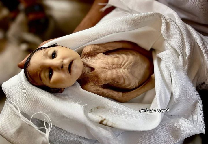 وفاة الطفلة غدير بريكة ( 5 أشهر) نتيجة إصابتها بسوء التغذية وعدم التوفر العلاج اللازم لحالتها الصحية بعد ولادتها، بفعل حصار غزة وحرب الإبادة المستمرة