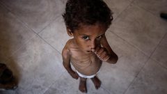 منظمة دولية: المجاعة وسوء التغذية الحاد في غزة وصل حده الأقصى