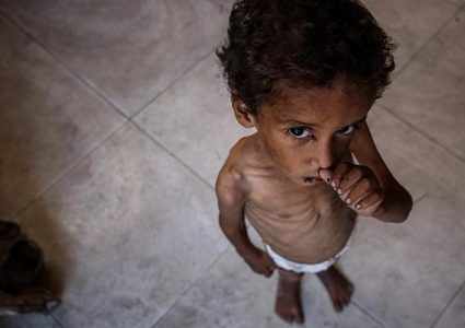 منظمة دولية: المجاعة وسوء التغذية الحاد في غزة وصل حده الأقصى