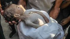 11 وفاة نتيجة المجاعة وسوء التغذية خلال الـ 24 ساعة الماضية