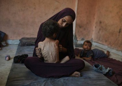 3 وفيات نتيجة المجاعة وسوء التغذية خلال الـ 24 ساعة الماضية