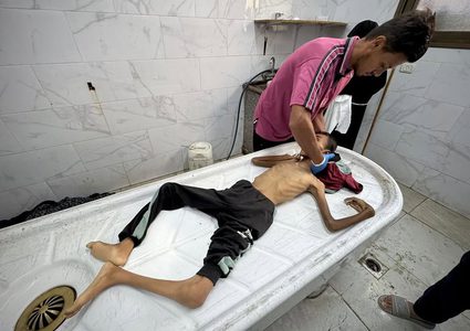 10 وفيات نتيجة المجاعة وسوء التغذية خلال الـ24 ساعة الماضية