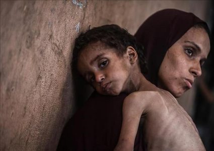 4 وفيات بينهم طفلان نتيجة المجاعة وسوء التغذية خلال الساعات الـ24 الماضية